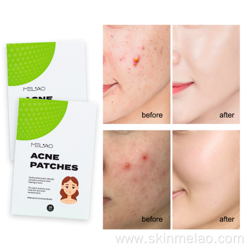 Blemishes Spot Stickers Vegan Waterproof Acne Patches